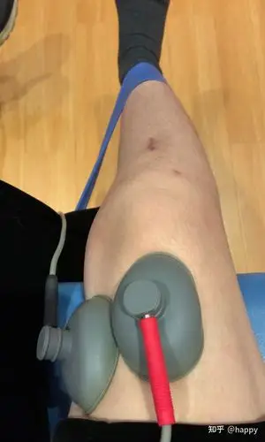 我的前叉重建及术后康复