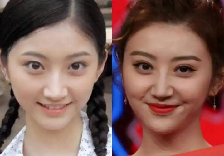 32岁景甜在出镜间,首度承认整容失败!