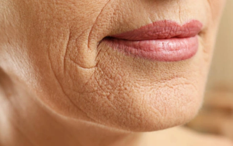 热巴被人吐槽皮肤松弛?看小编这几招,让你"物美价廉"的科学抗皱!