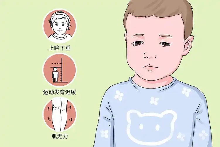 先天性肌无力综合征