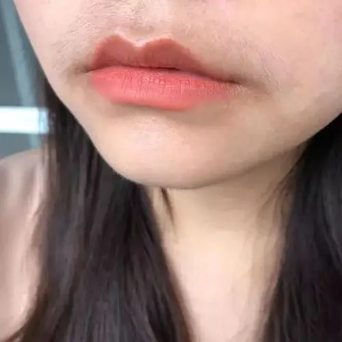 铂钰女生尴尬的小胡子原来是雄激素在作祟