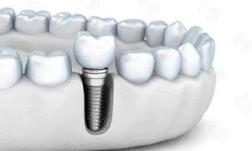 在乌鲁木齐给老年人种植牙,有哪些不错的口腔医院? - 贝色口腔