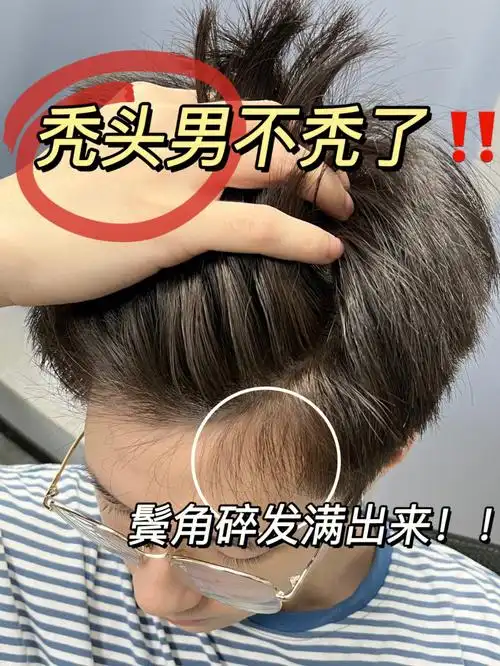 鬓角碎发都洗出来了用这洗发水防脱不愁