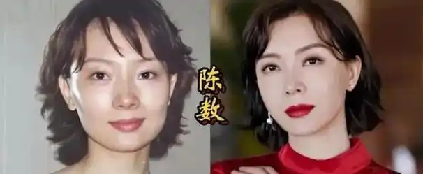 陈数整容后遗症明显,面部肿胀轮廓扭曲,演艺事业下坡路或将开始
