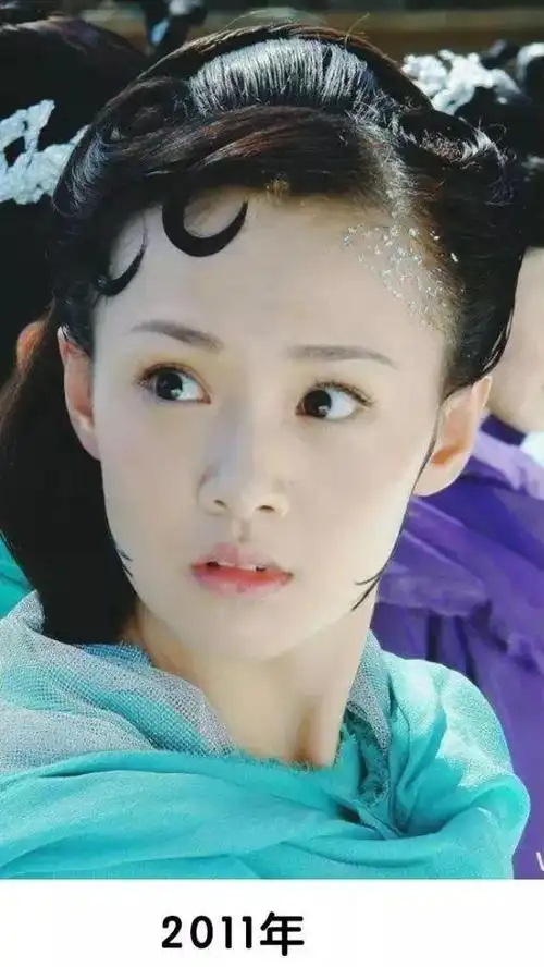 郑爽十年换了4张脸,最新路拍生曝光,假体都藏不住了