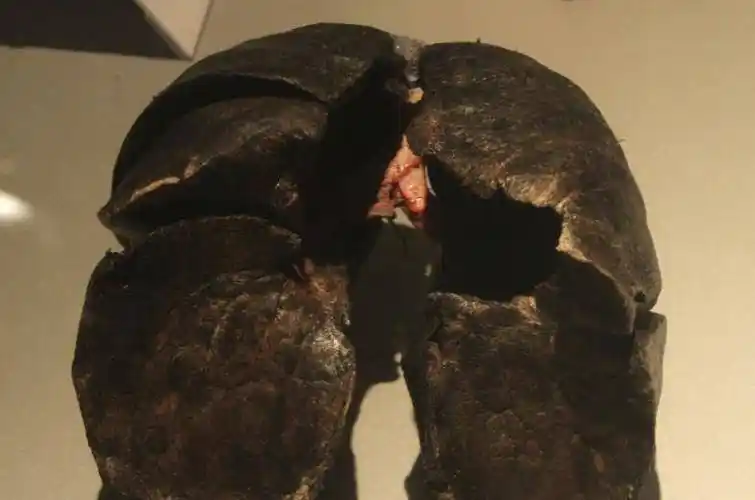 老人肺病离去火化后,尸骨中惊现黑色的"舍利子"_患者_身体_恶性肿瘤