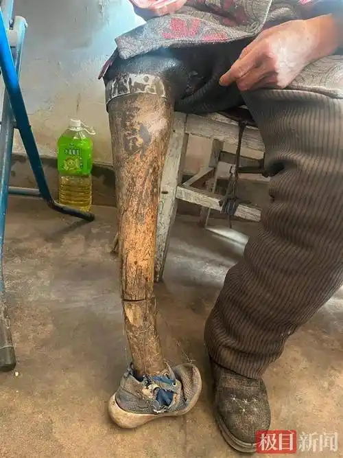 探访"马腿奶奶":自幼截肢习惯了"木腿",儿子是村里的骄傲_韩香_假肢