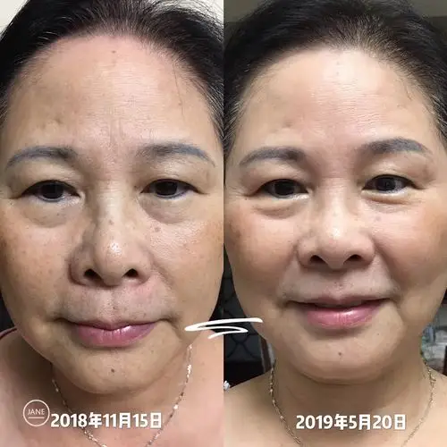 皮肤为什么会衰老的那么快?