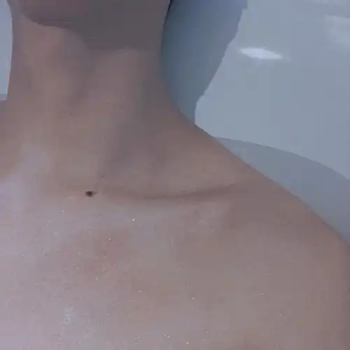 可以在锁骨网鱼吗