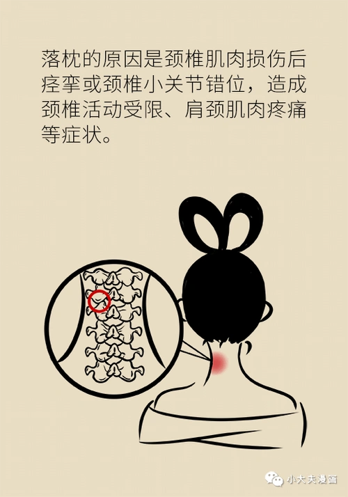 又双叒落枕了肌肉痉挛还是关节错位4个妙招快速缓解