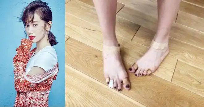 拥有"丑脚"的女星,王子文最苦命,徐若瑄动手术,宋茜最让人心疼!