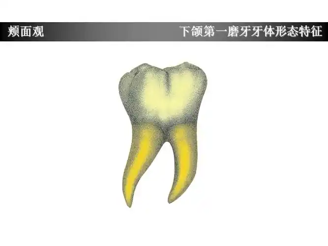 下颌第一磨牙牙体形态简述