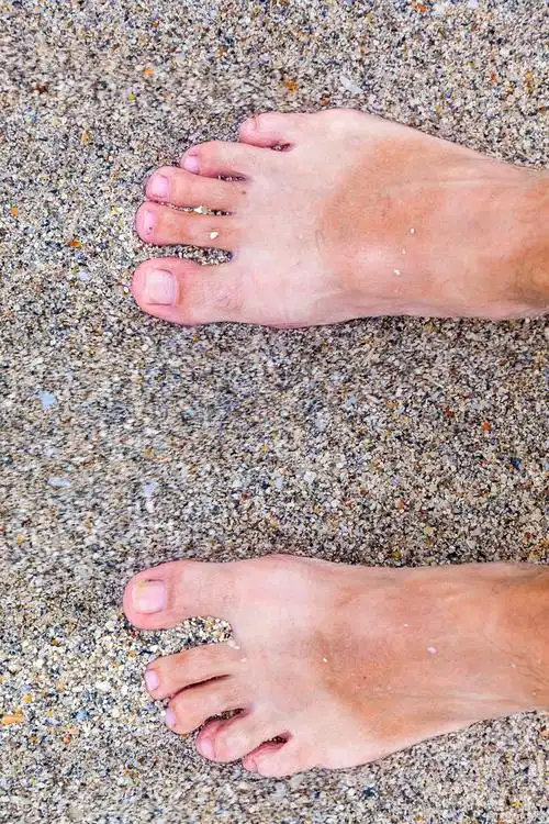 夏日里如何做好脚丫的防晒和美白