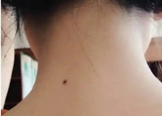 女人的旺夫痣通常都是在脖子附近的,而且也是在脖子的后方,这代表的就