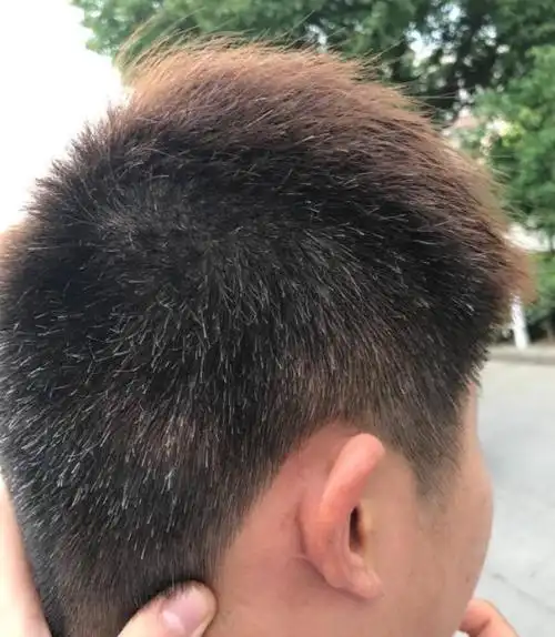 若女性白头发增多不要总认为是老了或是因为体内缺乏2种营养