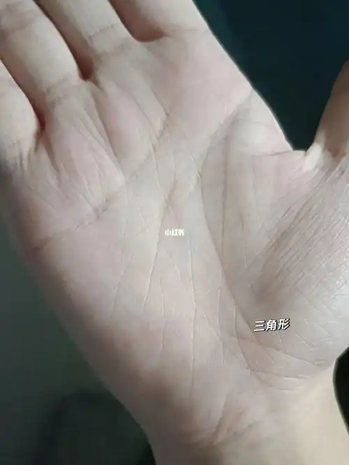 生命线末尾有三角形就是痛经