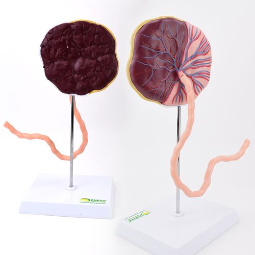 胎盘脐带组织结构解剖模型妊娠组织胚胎教学妇产科教学教具胎盘绒毛