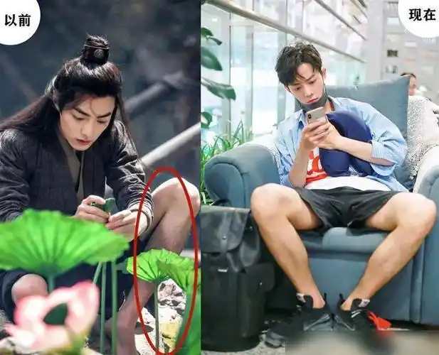 肖战剃了腿毛希望他不要再向肚毛下手体毛过重不是他的错