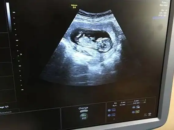 nt照片中平躺的就是女孩谁有对照图片