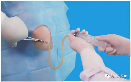 【每日技能】胸腔穿刺术操作步骤,考试注意事项