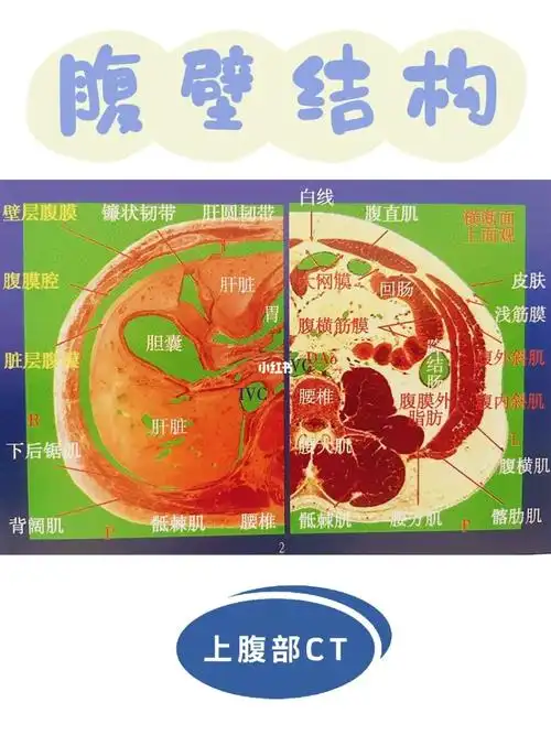 腹壁结构上腹部ct