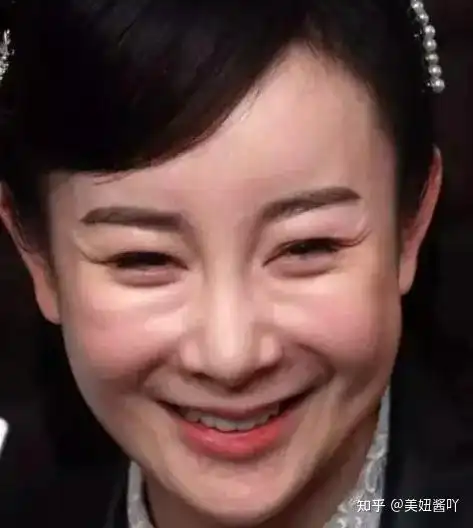 哪些明星的脸已经/快要崩了?