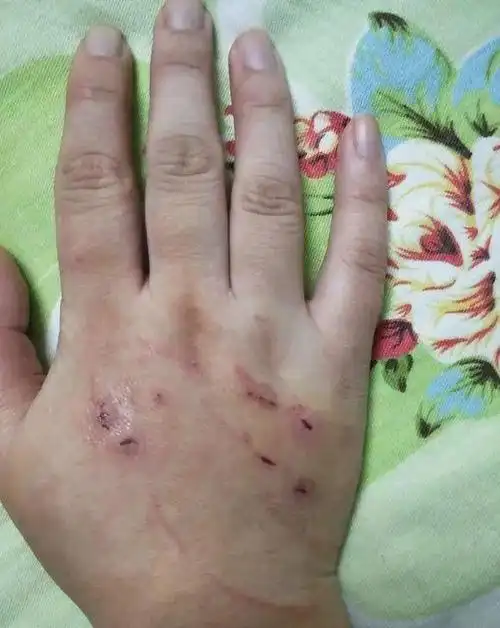 被猫咬了以后,主人生气痛揍猫咪5分钟,但现在后悔死了!