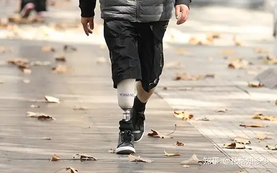 什么是假肢接受腔 - 知乎