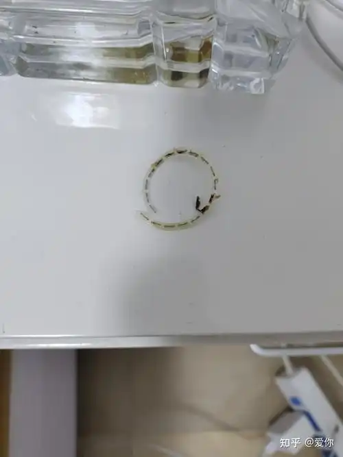 环切包皮手术大家的钛钉都是多久掉了啊大家用盐水