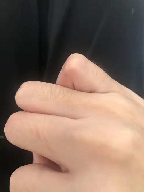 为什么我的手毛这么长