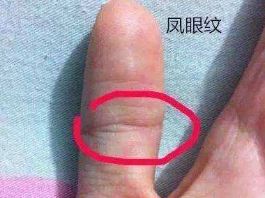 首页 手相图解 > 正文我们知道,凤眼纹的手相是凤眼两端必须是闭合的