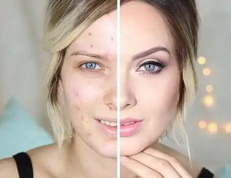 皮肤不好的妹子怎么才能让肌肤变好