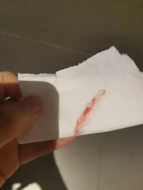 (有图慎入)排卵期出血了,怎么回事啊这是