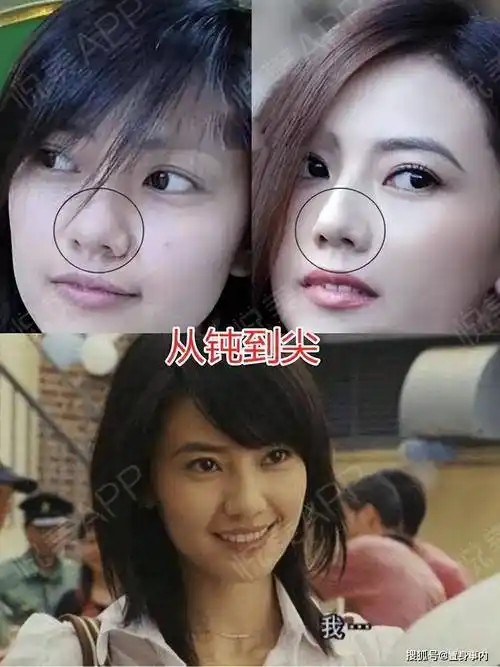 高圆圆早期的颧骨也是比较高的,如果是普通人是完全不影响颜值的,但是