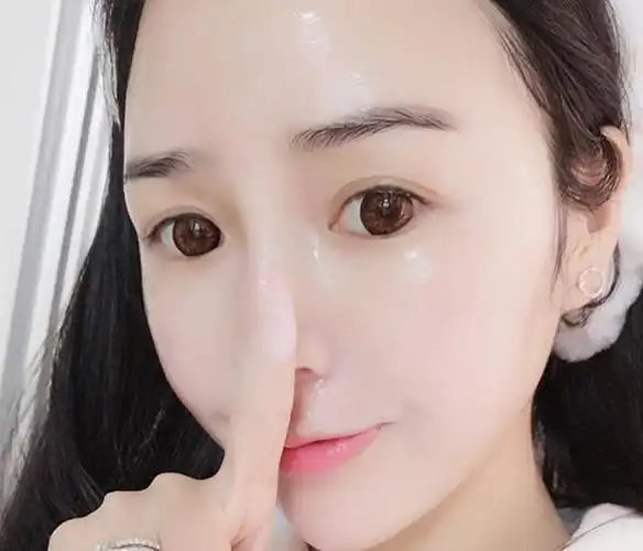 毛孔粗大脸就坑坑洼洼进来教你一招轻轻松松提亮肤色