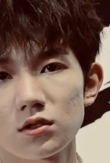 有种"毁容"叫王源吸烟,一脸粉刺痘坑扎堆,网友:泡面可以补