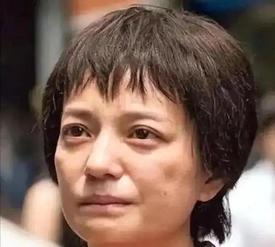 赵薇被封杀三年后近照曝光素颜苍老明显发福了手腕淤青
