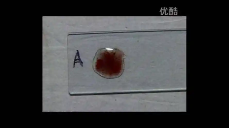 凝集 搜索资料 本地图片 图片链接 提交回答 匿名