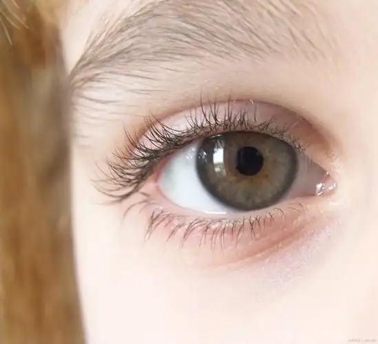 如何缓解眼睑痉挛?