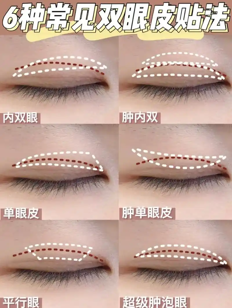 肿眼泡单眼皮教程 #双眼皮贴 #双眼皮贴教程 - 抖音