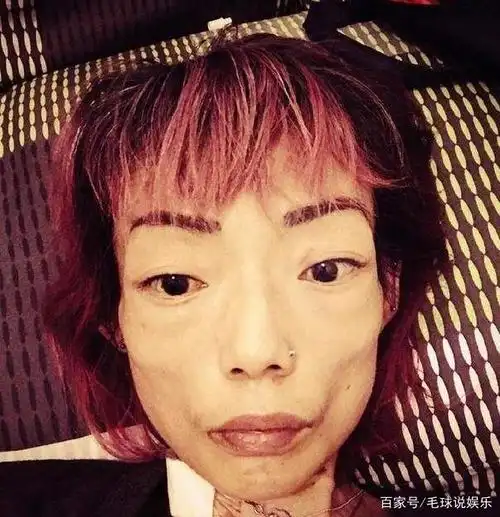 嫁入豪门,8年后离婚体重仅44斤,丈夫再娶,她却靠轮椅度日