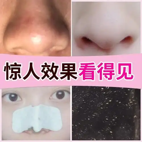 鼻贴eiio去黑头儿童用学生青少年神器女生草莓小孩鼻贴