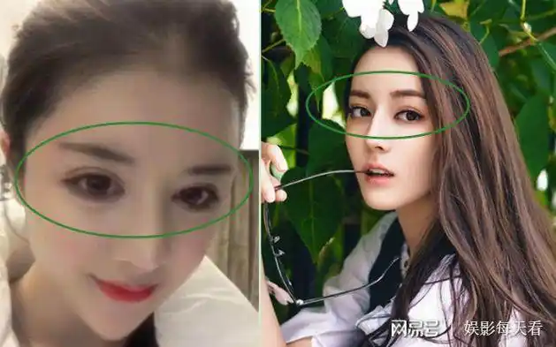 迪丽热巴整容却成阿凡达高伟光崩溃了