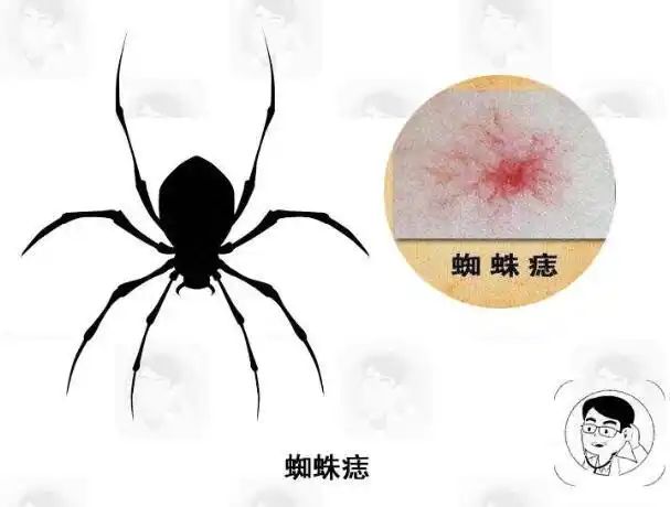 红痣与朱砂痣区别图片(红痣与朱砂痣是什么意思)