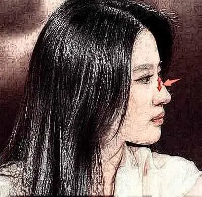 鼻梁露骨的女人