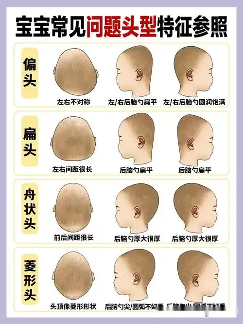一边圆润好看,一边扁平垂直扁头①头窄后宽 ,头型前面窄小,后面宽大②