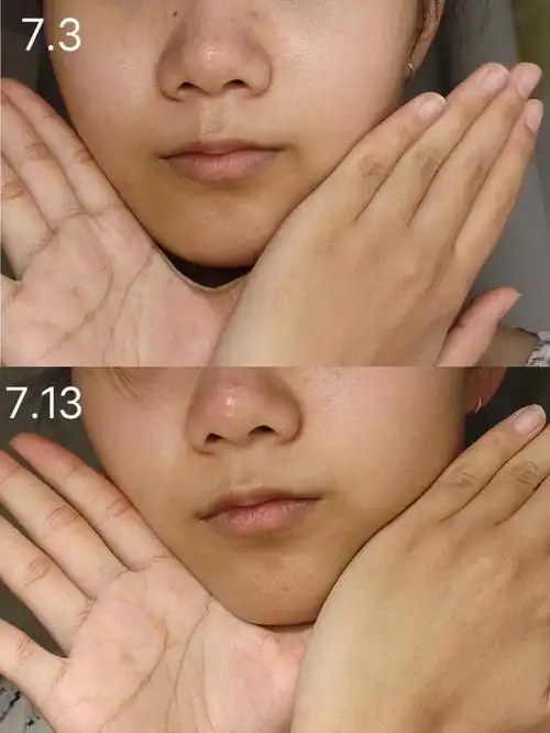 普通人变白测评第二周肉眼可见的变化