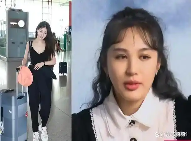 女星扎堆变脸金晨辨识度降低杨紫张不开嘴谁让人心疼