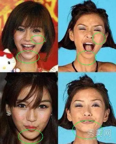 angelababy整容前后对比照