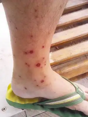 哈市文林街一居民楼跳蚤成灾 十多户居民被咬寝食难安